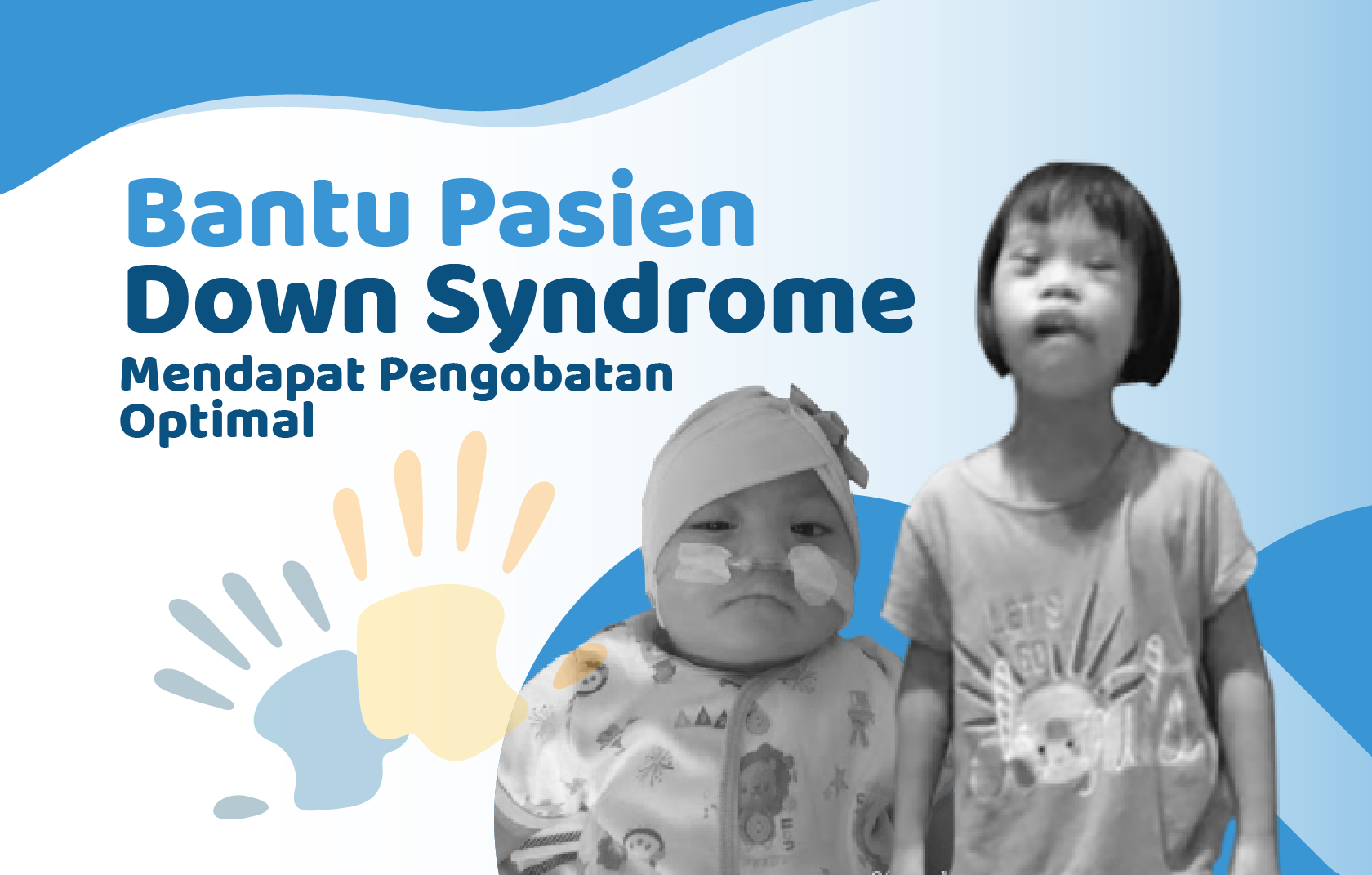 Bantu Pasien Down Syndrome Mendapat Pengobatan Maksimal